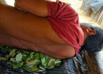 Yulius Kale Rabe (LAPENDOS) Keluhkan Penanganan Kasus Penganiayaan oleh Polres Sabu Raijua
